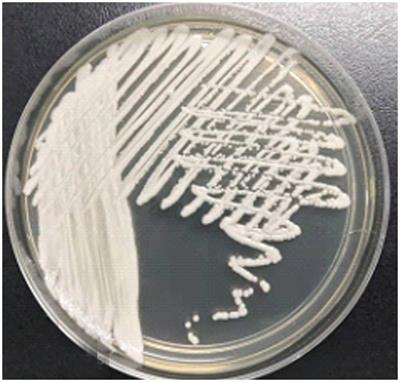 Candida auris infection; diagnosis, and resistance mechanism using high-throughput sequencing technology: a case report and literature review